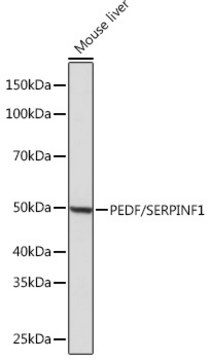 Anti-PEDF/SERPINF1 Antibody, clone 4H0C5, Rabbit Monoclonal