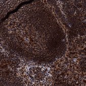 Anti-RNASEH2B antibody produced in rabbit Prestige Antibodies® Powered by Atlas Antibodies, affinity isolated antibody, buffered aqueous glycerol solution