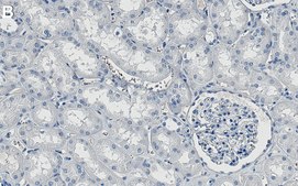 Anti-NEDD4 Antibody, clone 1D20 ZooMAb® Rabbit Monoclonal recombinant, expressed in HEK 293 cells