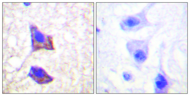 Anti-CD130 antibody produced in rabbit affinity isolated antibody