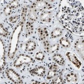 Anti-LUC7L3 antibody produced in rabbit Prestige Antibodies® Powered by Atlas Antibodies, affinity isolated antibody, buffered aqueous glycerol solution, Ab1
