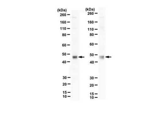 Anti-Vaccinia related kinase-1 Antibody, N-Terminus from rabbit