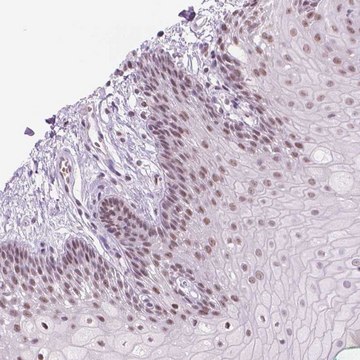 Anti-POLR3D antibody produced in rabbit Prestige Antibodies&#174; Powered by Atlas Antibodies, affinity isolated antibody, buffered aqueous glycerol solution