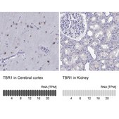 Anti-TBR1 Prestige Antibodies® Powered by Atlas Antibodies