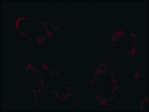 Anti-Superoxide Dismutase (MnSOD) (DD-17)&#8722;Cy3 antibody produced in rabbit 1-2&#160;mg/mL, affinity isolated antibody, buffered aqueous solution