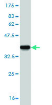 Monoclonal Anti-CYP24A1 antibody produced in mouse clone 1F8, purified immunoglobulin, buffered aqueous solution