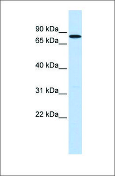 Anti-DDX41 antibody produced in rabbit affinity isolated antibody