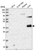 Anti-ZNF385B antibody produced in rabbit Prestige Antibodies® Powered by Atlas Antibodies, affinity isolated antibody