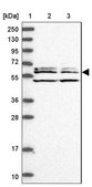 Anti-WDCP antibody produced in rabbit Prestige Antibodies® Powered by Atlas Antibodies, affinity isolated antibody, buffered aqueous glycerol solution