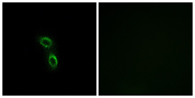 Anti-ARMC6 antibody produced in rabbit affinity isolated antibody