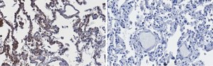 Anti-ACE2-extracellular Antibody, clone 1F21 ZooMAb® Rabbit Monoclonal recombinant, expressed in HEK 293 cells
