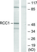 Anti-Retinoic Acid Receptor &#946;, C-Terminal antibody produced in rabbit affinity isolated antibody