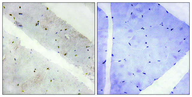 Anti-LATS2 antibody produced in rabbit affinity isolated antibody