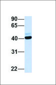 Anti-CCR5 antibody produced in rabbit affinity isolated antibody