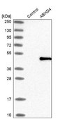 Anti-ABHD4 antibody produced in rabbit Prestige Antibodies® Powered by Atlas Antibodies, affinity isolated antibody, buffered aqueous glycerol solution