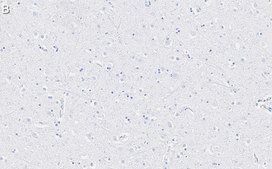 Anti-EAAT2 Antibody, clone 1K8 ZooMAb® Rabbit Monoclonal recombinant, expressed in HEK 293 cells