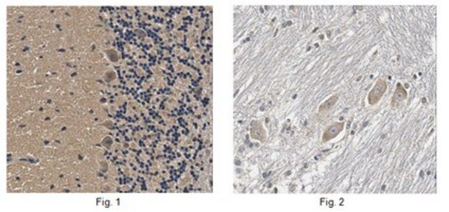 Anti-CLN3 Antibody, Clone 2B8.2 clone 2B8.2, from mouse