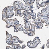 Anti-AOAH antibody produced in rabbit Prestige Antibodies® Powered by Atlas Antibodies, affinity isolated antibody, buffered aqueous glycerol solution