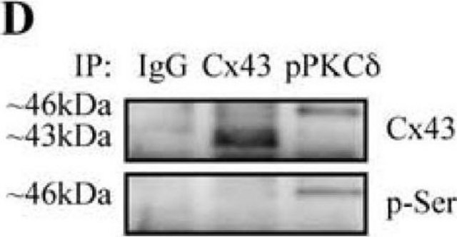 单克隆抗-磷酸丝氨酸 小鼠抗 clone PSR-45, purified immunoglobulin, buffered aqueous solution