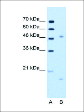 Anti-ITGBL1 (AB1) antibody produced in rabbit IgG fraction of antiserum