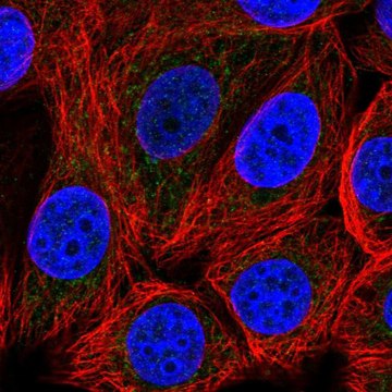 Anti-SLC25A51 antibody produced in rabbit Prestige Antibodies&#174; Powered by Atlas Antibodies, affinity isolated antibody