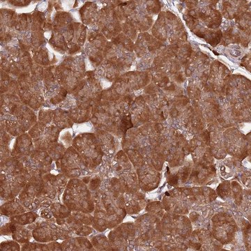 Anti-COG4 antibody produced in rabbit Prestige Antibodies&#174; Powered by Atlas Antibodies, affinity isolated antibody, buffered aqueous glycerol solution