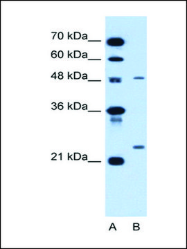 Anti-SMPD2 antibody produced in rabbit IgG fraction of antiserum