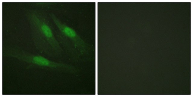 Anti-Catenin-&#946; antibody produced in rabbit affinity isolated antibody