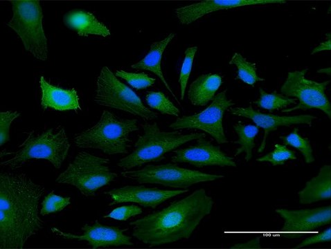 Anti-MASP1 antibody produced in mouse purified immunoglobulin, buffered aqueous solution