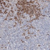 Anti-IFNAR1 antibody produced in rabbit Prestige Antibodies® Powered by Atlas Antibodies, affinity isolated antibody, buffered aqueous glycerol solution