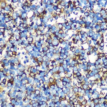 Anti-Alpha-Fetoprotein (AFP) antibody produced in mouse