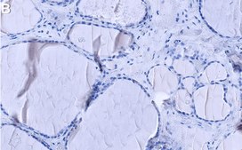 Anti-JNK1 Antibody, clone 1C18 ZooMAb® Rabbit Monoclonal recombinant, expressed in HEK 293 cells
