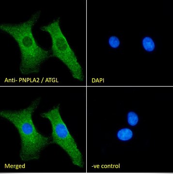 Anti-PNPLA2/ATGL antibody produced in goat affinity isolated antibody, buffered aqueous solution