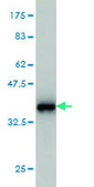 Monoclonal Anti-S100A8 antibody produced in mouse clone 2H2, purified immunoglobulin, buffered aqueous solution