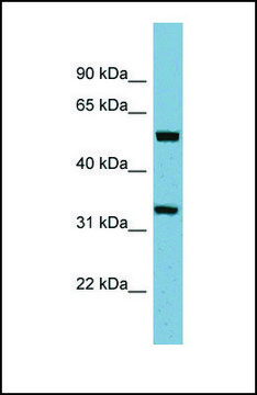 Anti-TMEM158 antibody produced in rabbit affinity isolated antibody