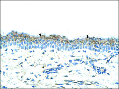 Anti-SerPINB5 antibody produced in rabbit IgG fraction of antiserum