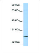 Anti-KLK6 antibody produced in rabbit affinity isolated antibody
