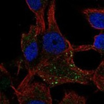 Anti-CD63 antibody produced in rabbit Prestige Antibodies&#174; Powered by Atlas Antibodies, affinity isolated antibody, buffered aqueous glycerol solution