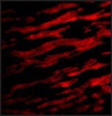 Anti-TIRAP (ab1) antibody produced in rabbit affinity isolated antibody, buffered aqueous solution