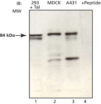 Anti-Tal (CS-15) antibody produced in rabbit affinity isolated antibody, buffered aqueous solution