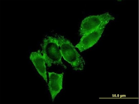 Monoclonal Anti-MMP9 antibody produced in mouse clone 2H4, purified immunoglobulin, buffered aqueous solution