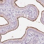 Anti-SLC6A19 antibody produced in rabbit Prestige Antibodies® Powered by Atlas Antibodies, affinity isolated antibody, buffered aqueous glycerol solution