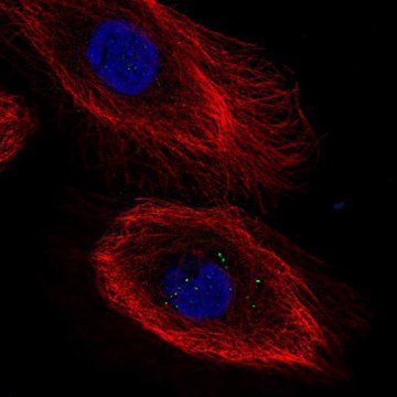 Anti-IL20RB antibody produced in rabbit Prestige Antibodies&#174; Powered by Atlas Antibodies, affinity isolated antibody