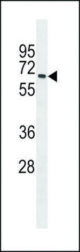 ANTI-MBOAT7 (CENTER) antibody produced in rabbit affinity isolated antibody, buffered aqueous solution