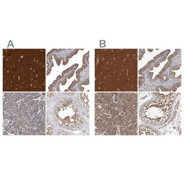 Anti-OXR1 antibody produced in rabbit Prestige Antibodies&#174; Powered by Atlas Antibodies, affinity isolated antibody, buffered aqueous glycerol solution, ab3