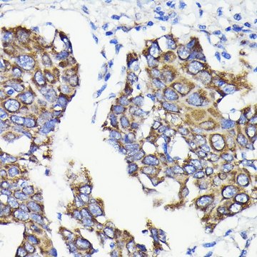 Anti- TTC11/FIS1 antibody produced in rabbit