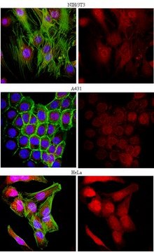 Anti-Thymosin beta-4 Antibody from rabbit, purified by affinity chromatography