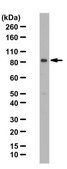 Anti-KAT7 Antibody (HBO1 / MYST2) from rabbit, purified by affinity chromatography
