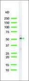 Anti-Keratin 18 antibody, Rabbit monoclonal recombinant, expressed in proprietary host, clone SP69, affinity isolated antibody