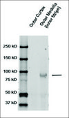 抗SCNN1B 兔抗 1 mg/mL, affinity isolated antibody